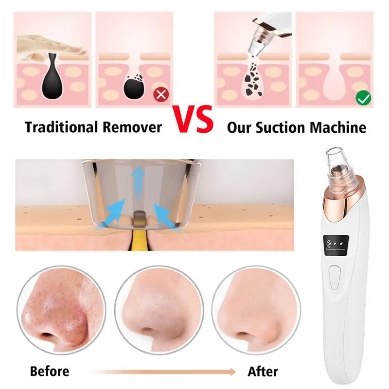 USB Rechargeable Facial Pore Cleaner with Blackhead Removal