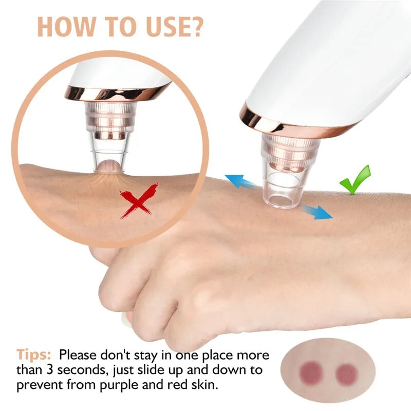 USB Rechargeable Facial Pore Cleaner with Blackhead Removal